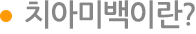 치아미백이란?