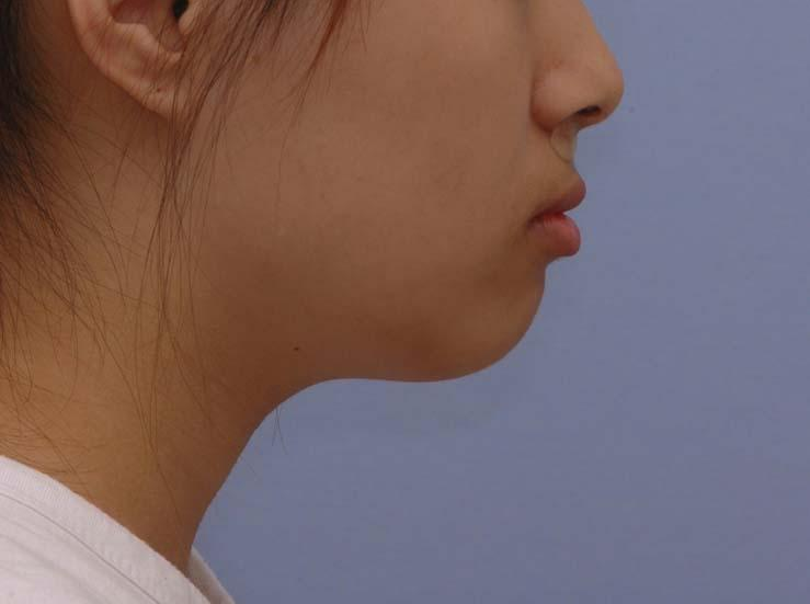 치료 전 사진입니다.
