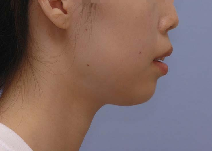 치료 전 사진입니다.