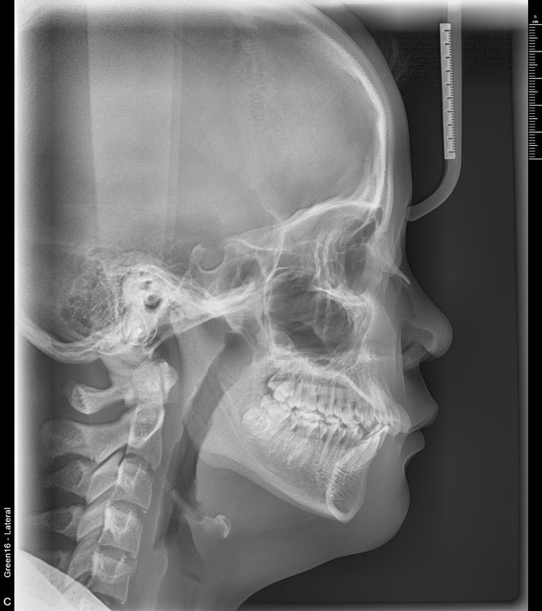 치료 전 사진입니다.