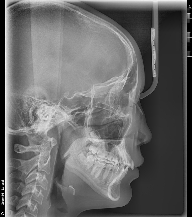 치료 전 사진입니다.